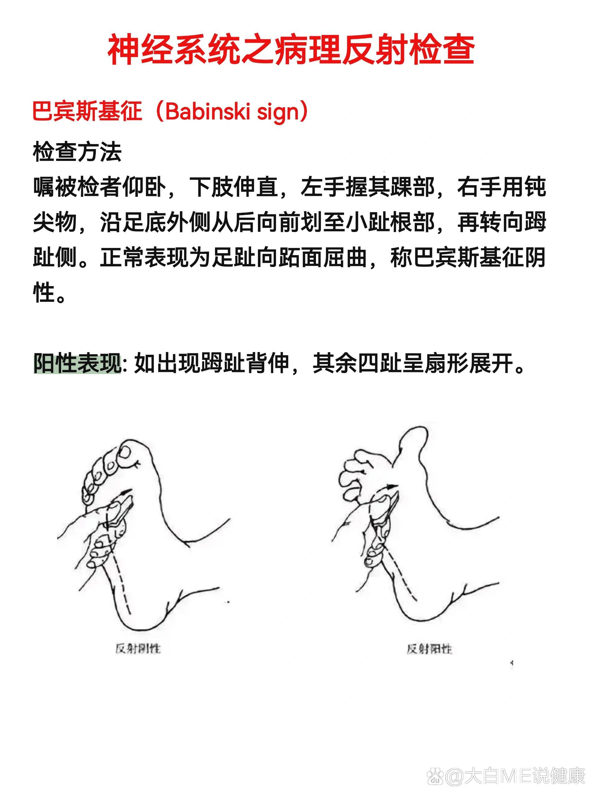 br 临床上常根据刺激的部位