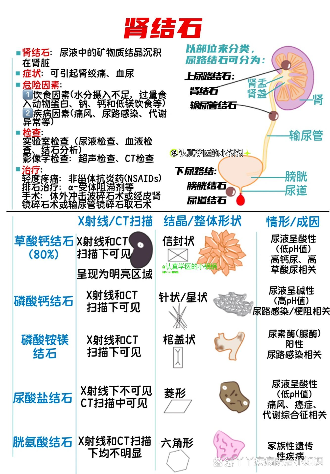 肾窦内结石图解图片