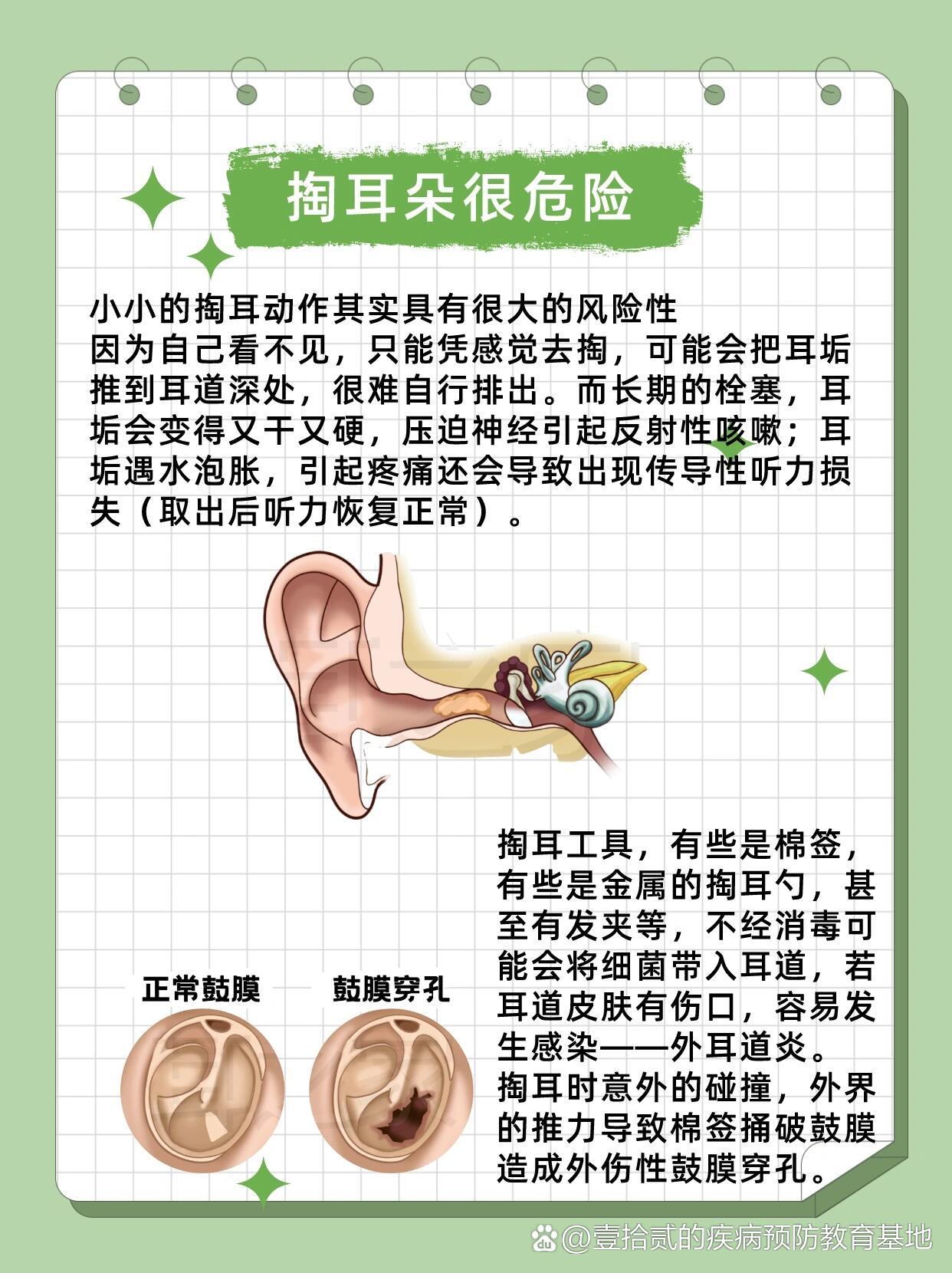 不要随便掏耳朵了74真的会受伤的