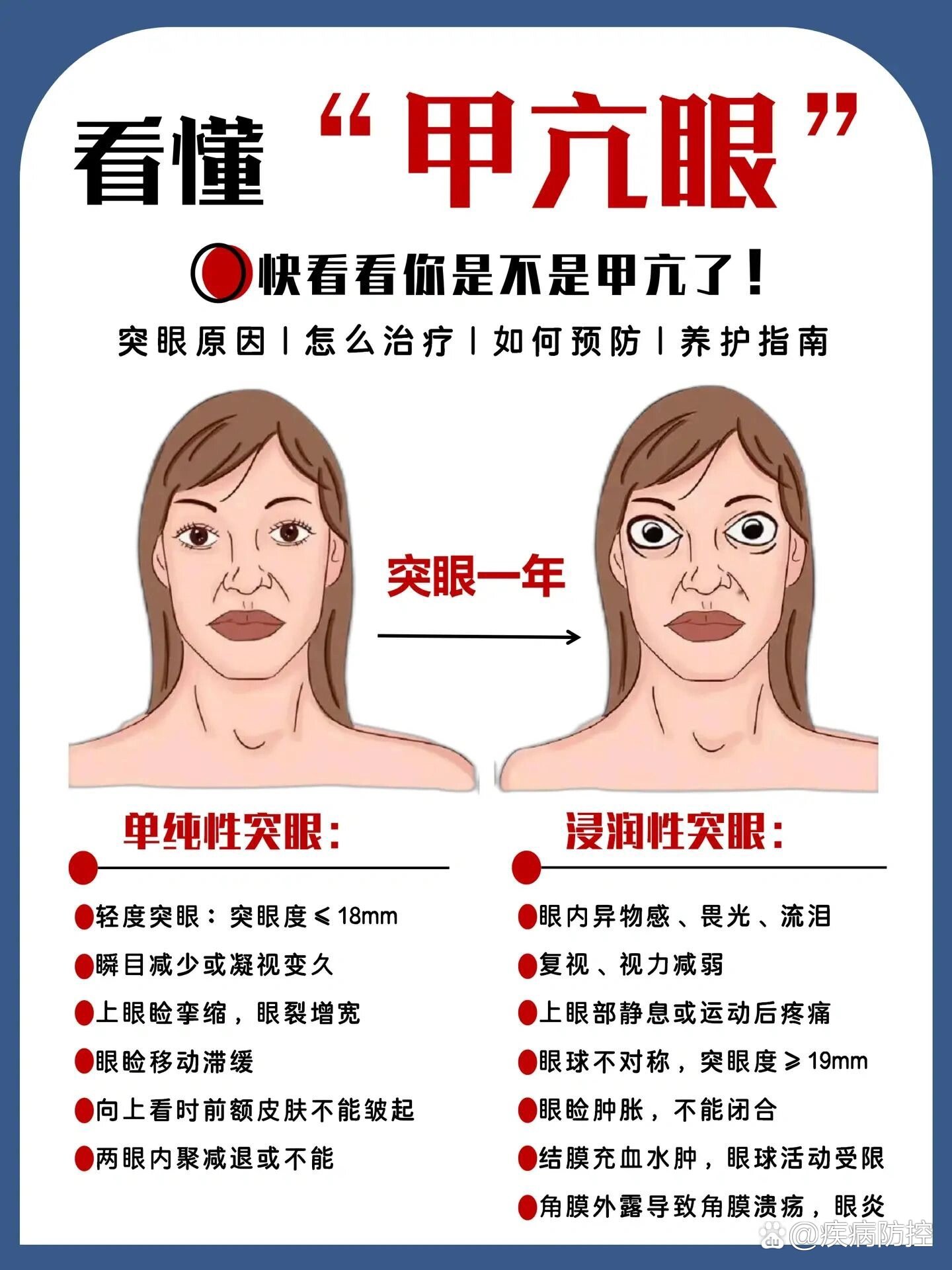 眼睛看物体变形图片