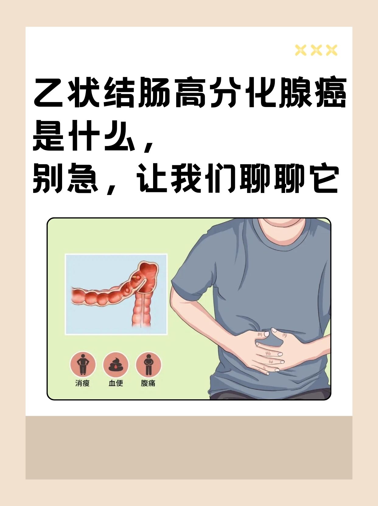 乙状结肠高分化腺癌是什么,别急,让我们聊聊它