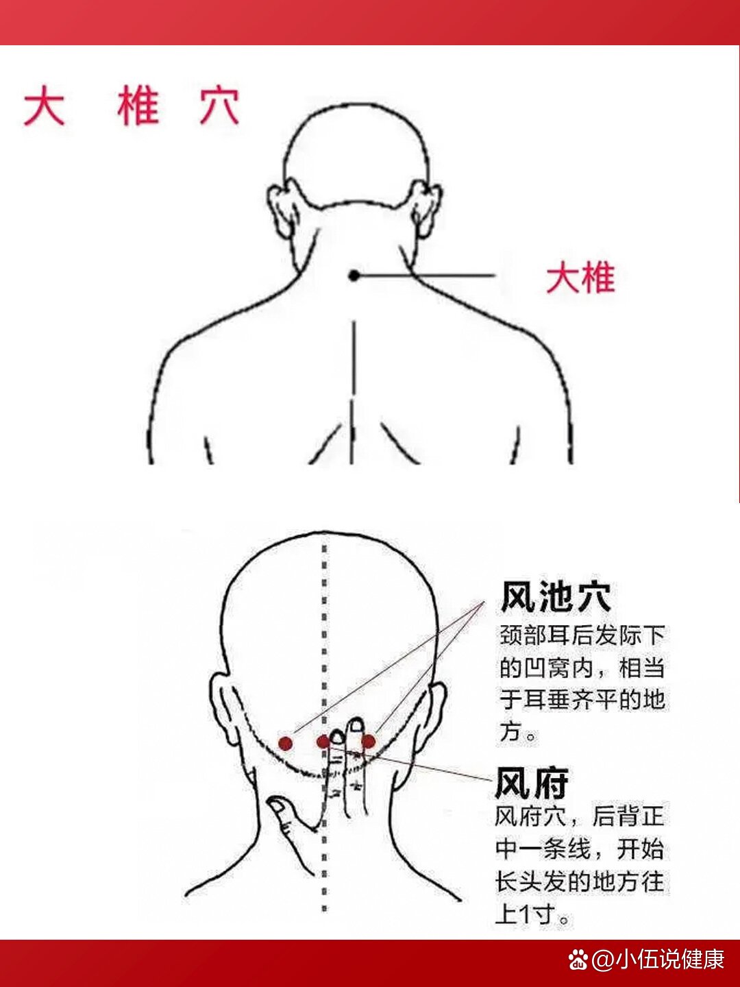 艾灸快速退烧方法图解