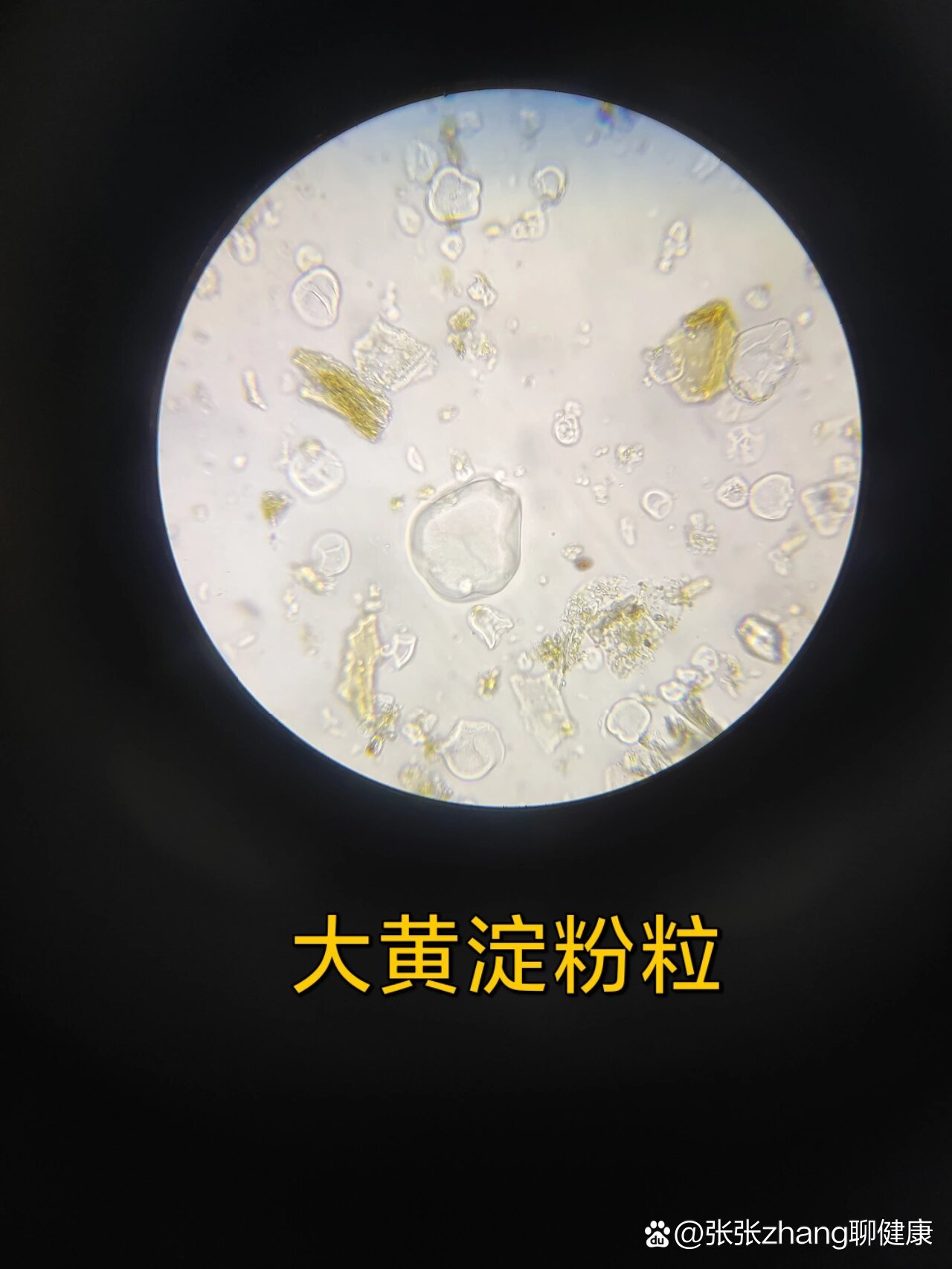  p>大黄粉末鉴别特征 br>淀粉粒,网纹导管,草酸钙簇晶 /p>