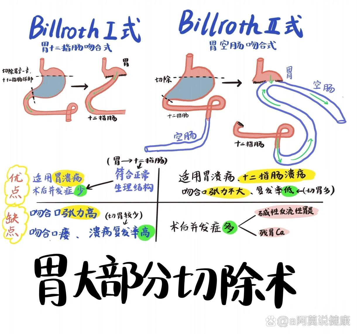 胃切除手术方式图片图片