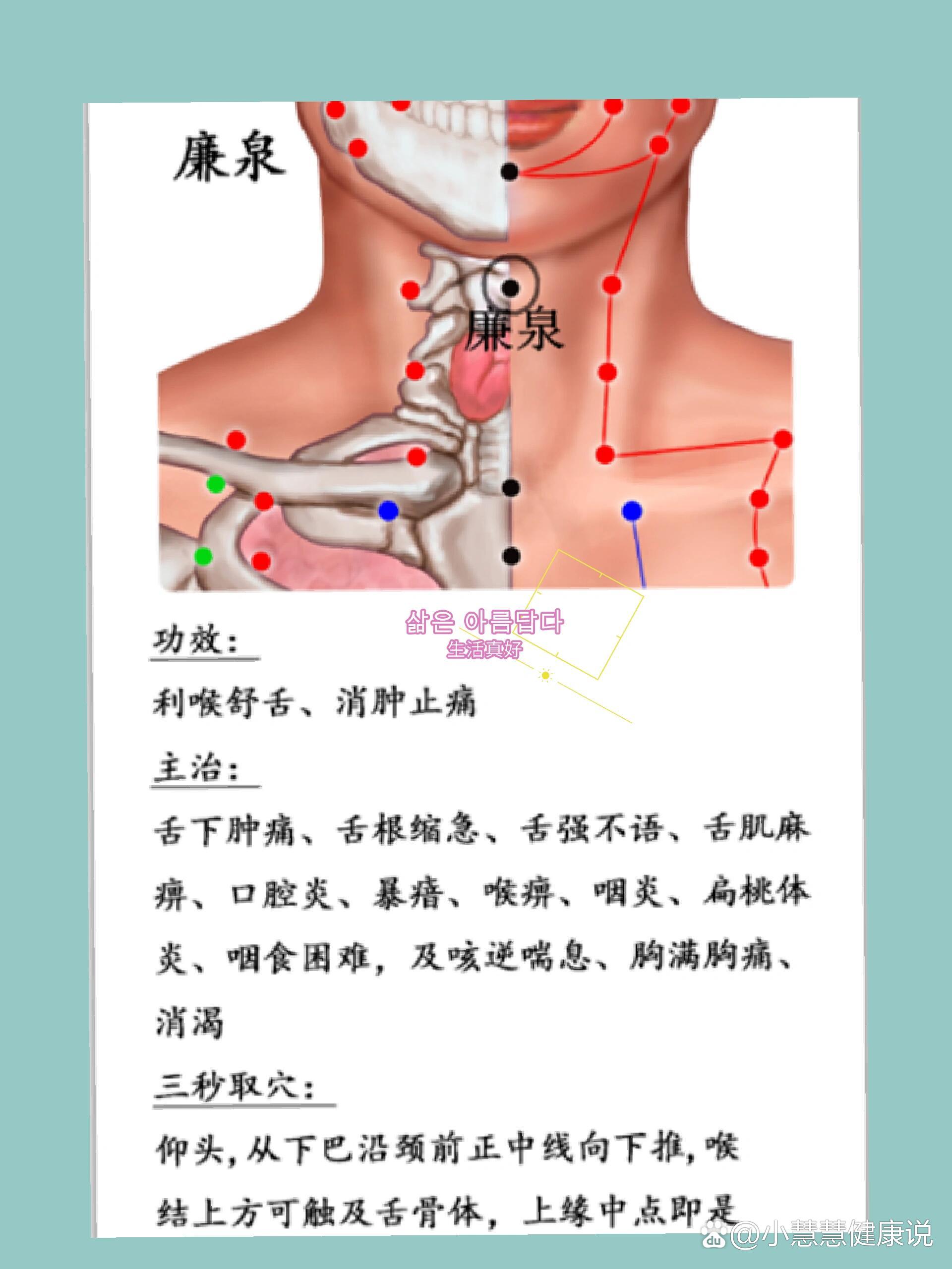 br 咽痛在98廉泉穴局部揪痧或者拔罐出痧