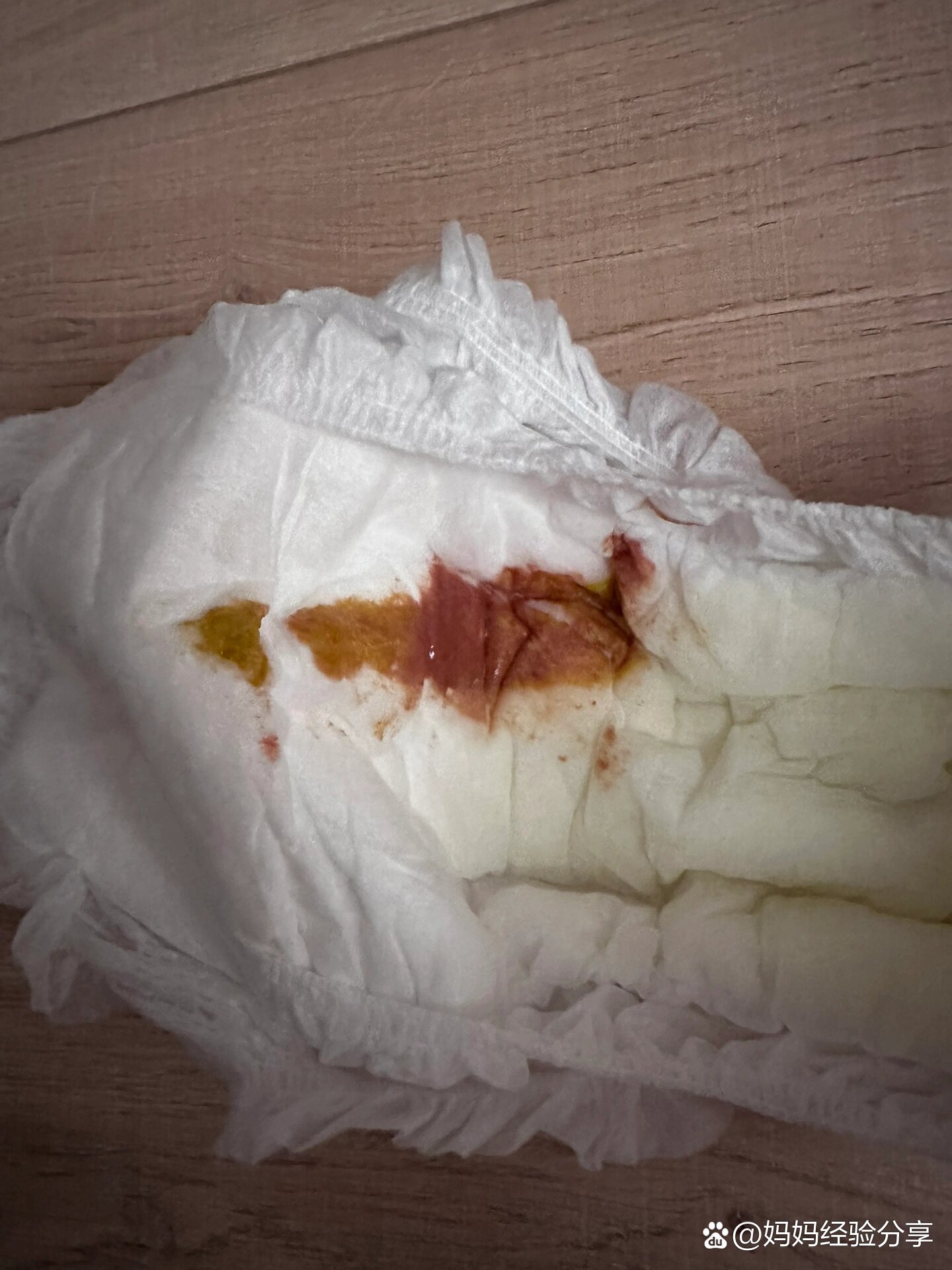 九个月宝宝大便有血(内有便便93)