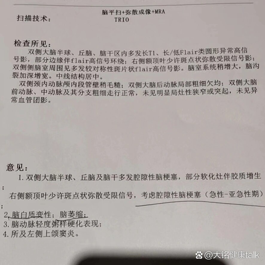 57岁,脑萎缩,脑梗塞😔(已更新后续)老爸生病了,今天刚出的脑ct