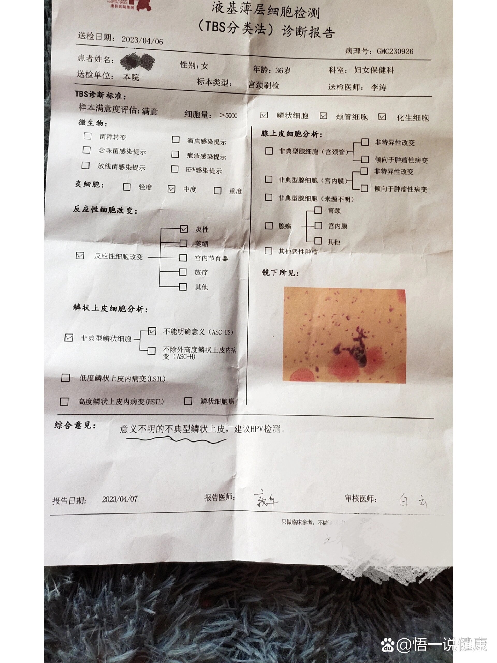 宫颈癌筛查和hpv  br>这周去拿了结果,hpv全阴的,tct意义不明的非典型