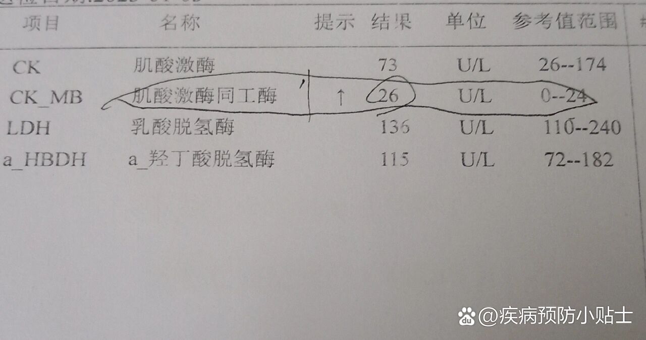 心肌酶化验单怎么看图片