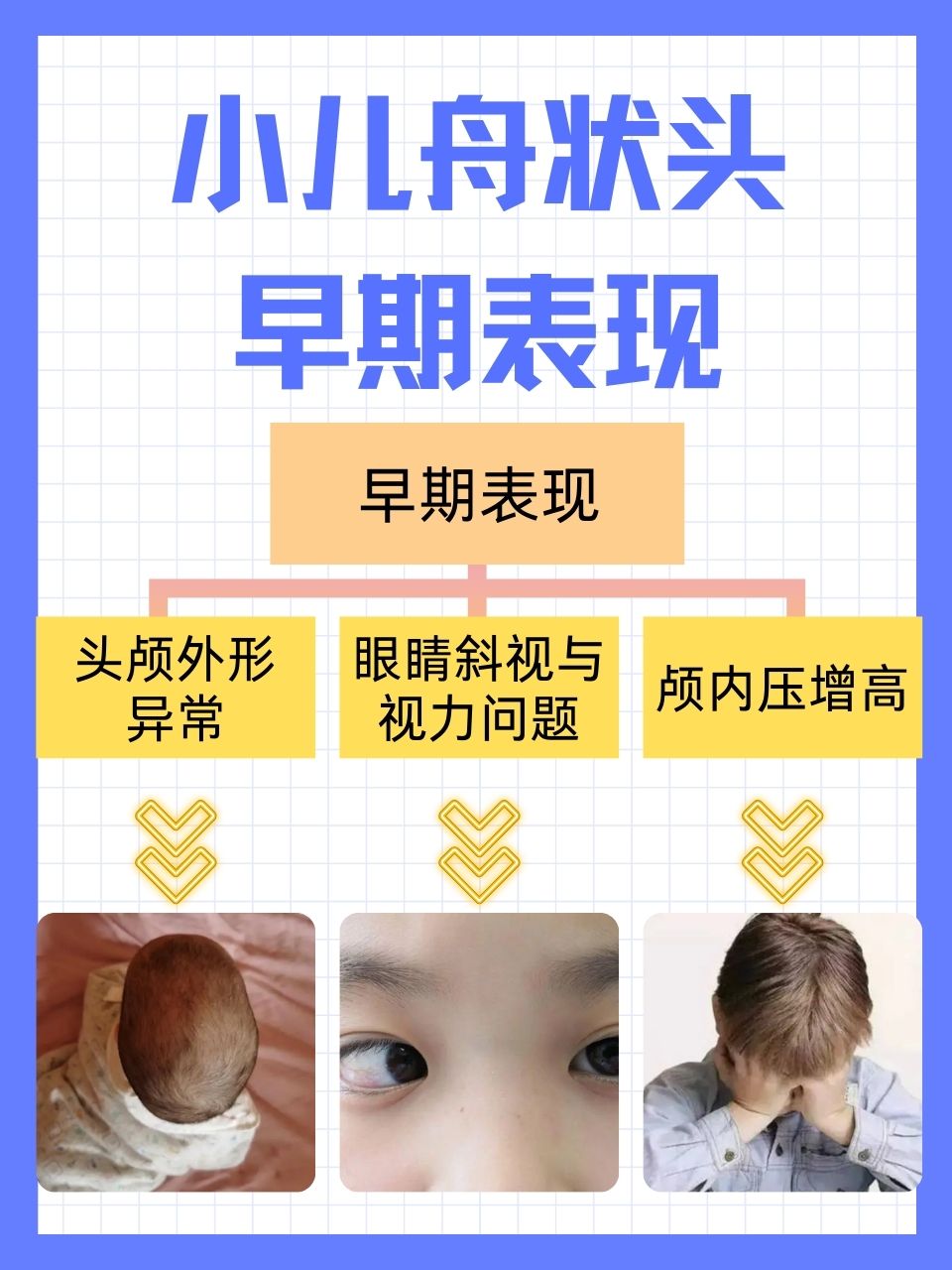 小儿舟状头的早期表现