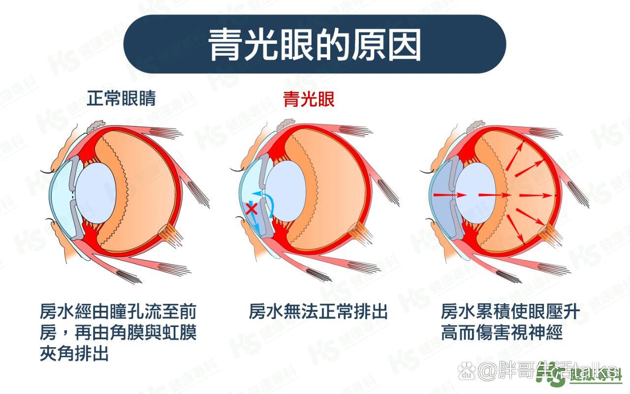 眼睛房水位置图片图片