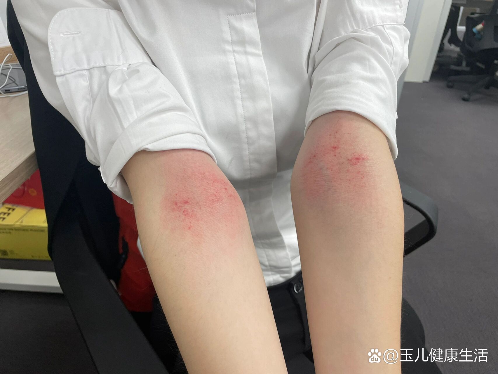 首次分享一个胃痛刮痧小方法95
