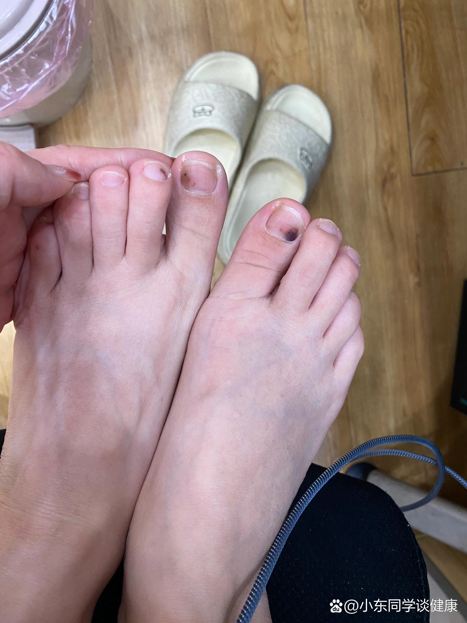 哪个知道脚丫子是怎么回事