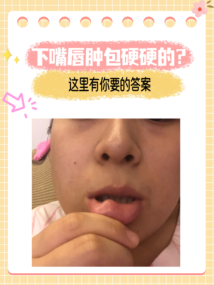 下嘴唇肿包硬硬的?这里有你要的答案