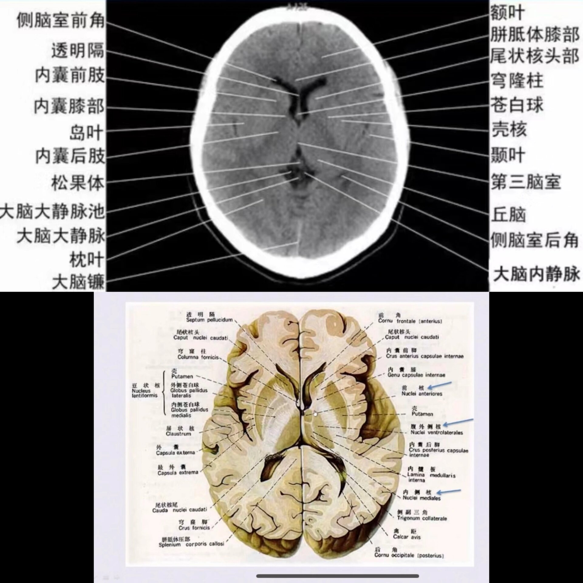 额叶的解剖结构图图片