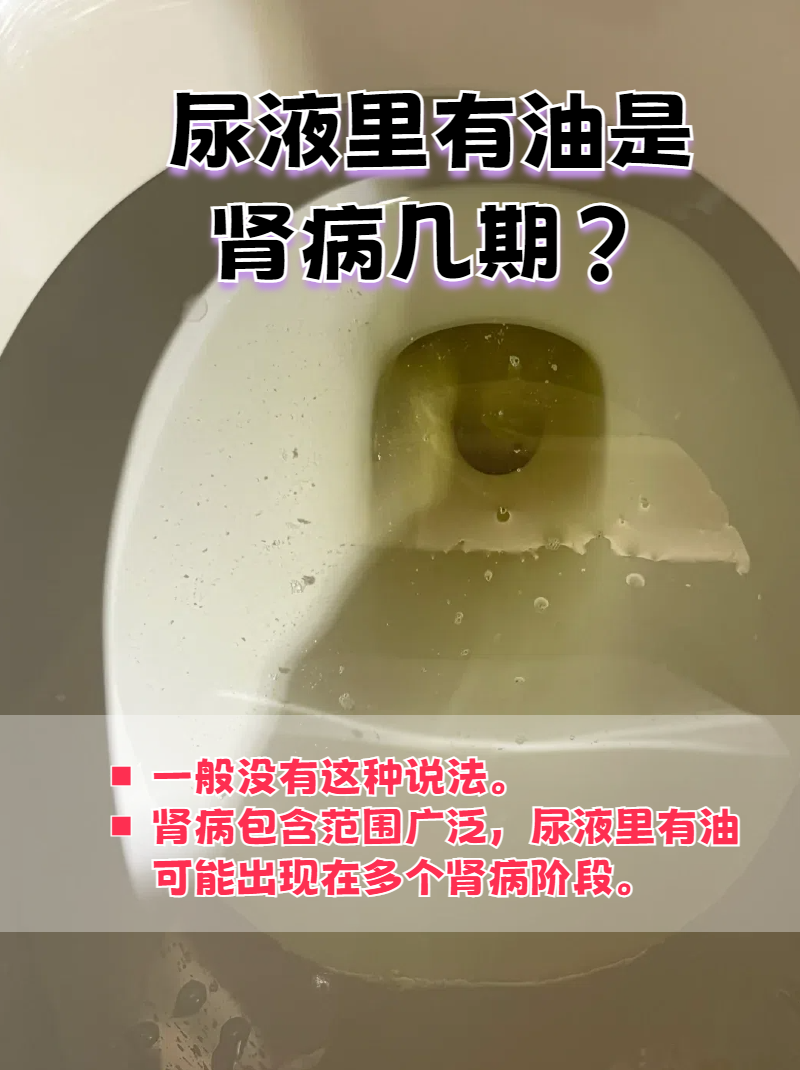 蚕豆病发病期尿液图片图片