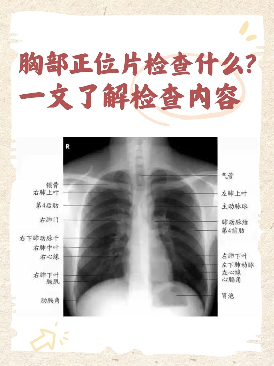 胸部正位片检查什么?一文了解检查内容