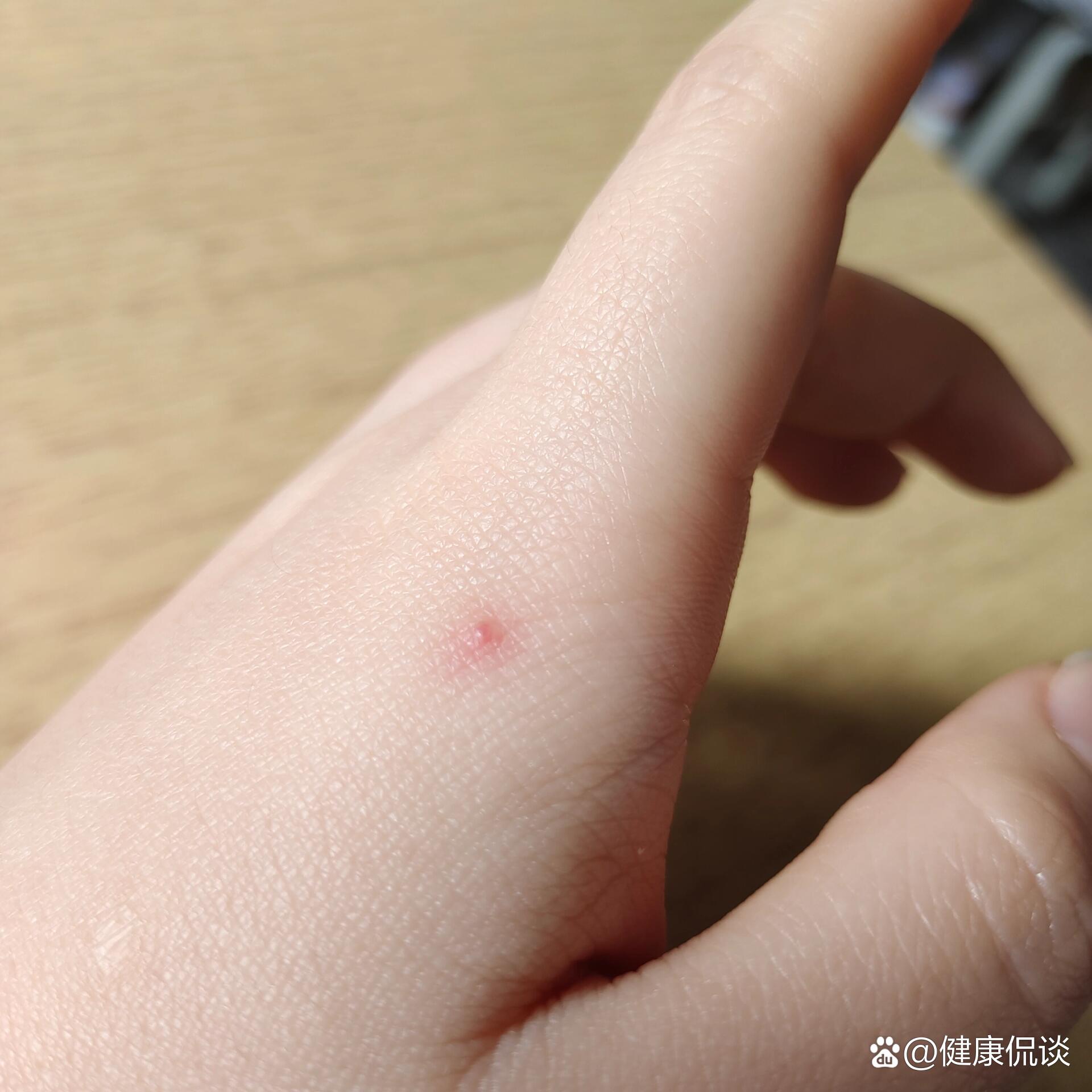 这是所谓的朱砂痣吗?