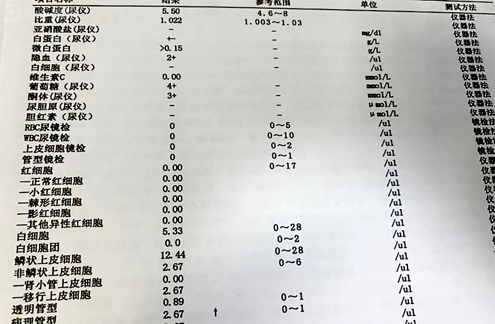 糖尿病并发症引起酮症酸中毒,排酮降糖后恢复如前-医疗科普-百度健康