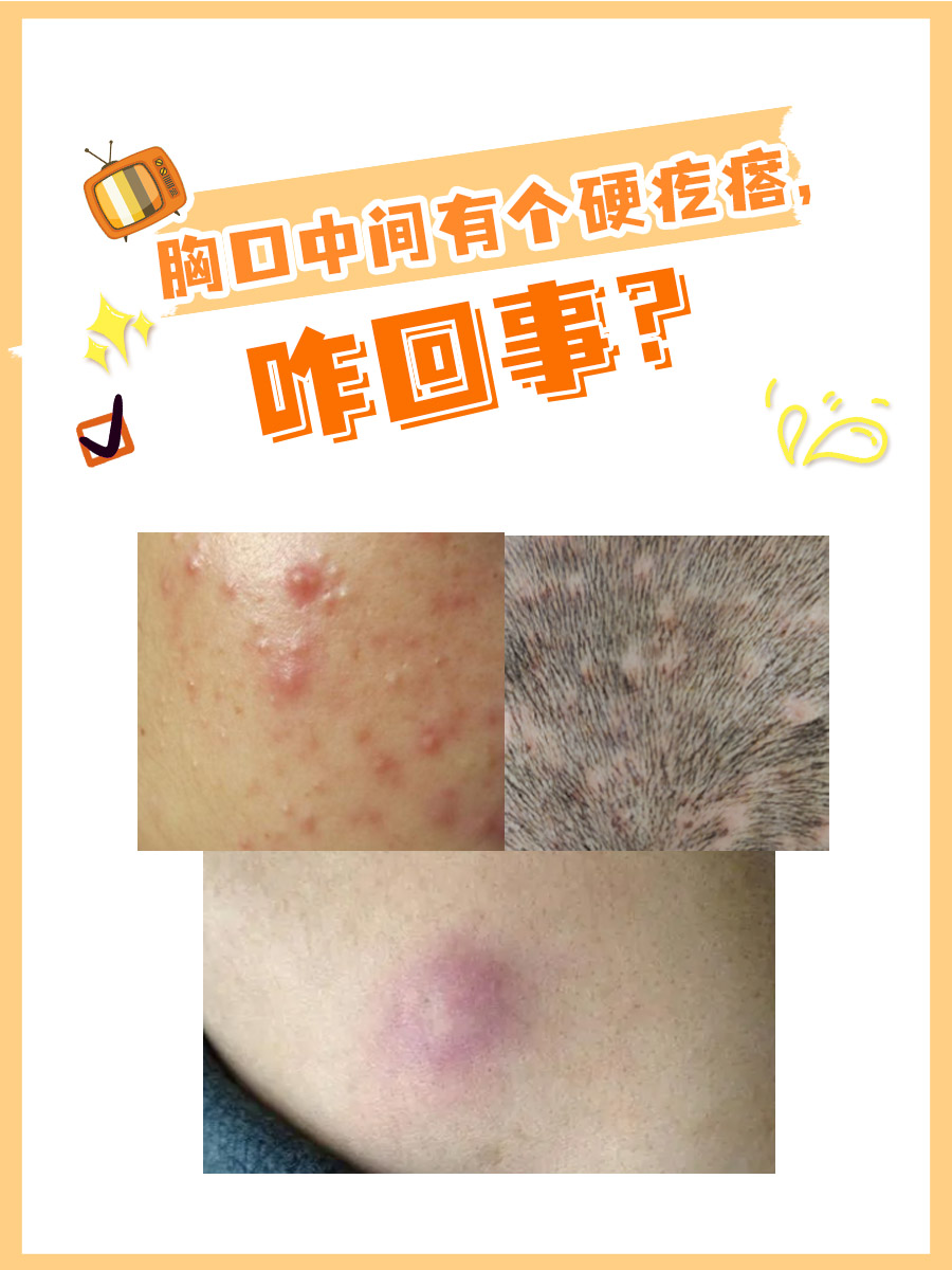 胸口中间有个硬疙瘩,咋回事?