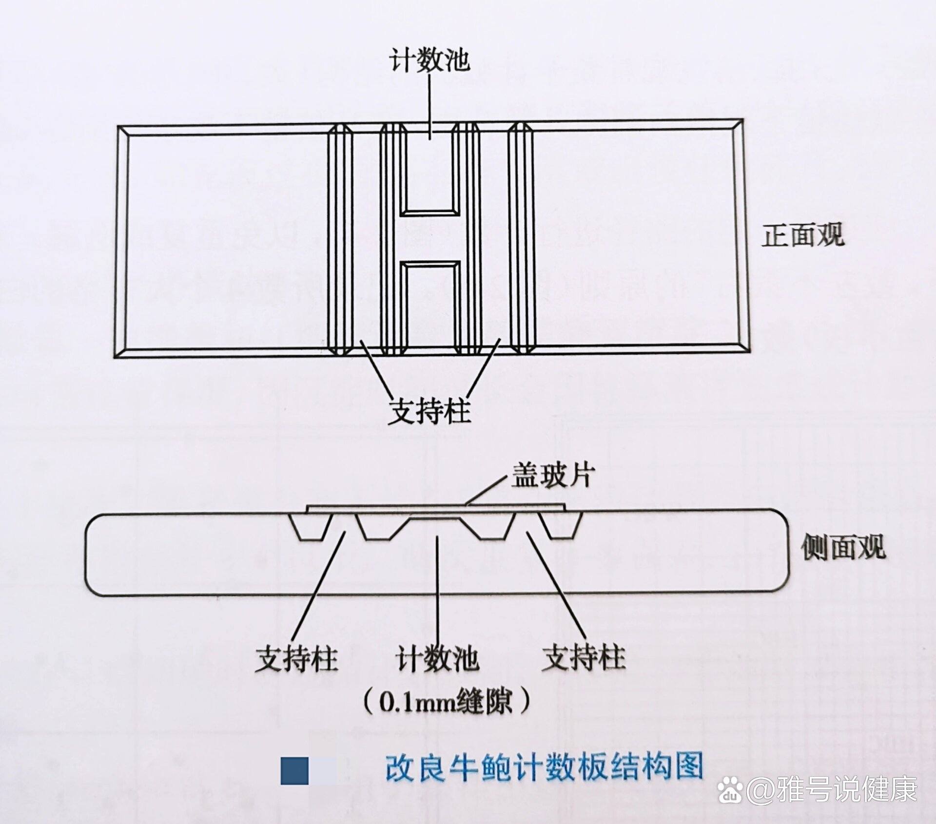 一张表看懂改良牛鲍血细胞计数板