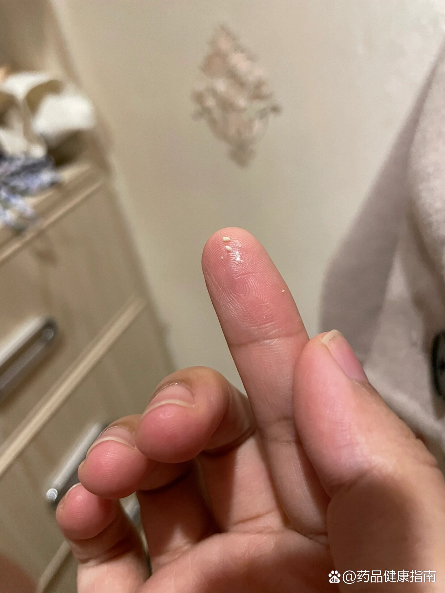 小白泡堵奶,乳腺炎发作