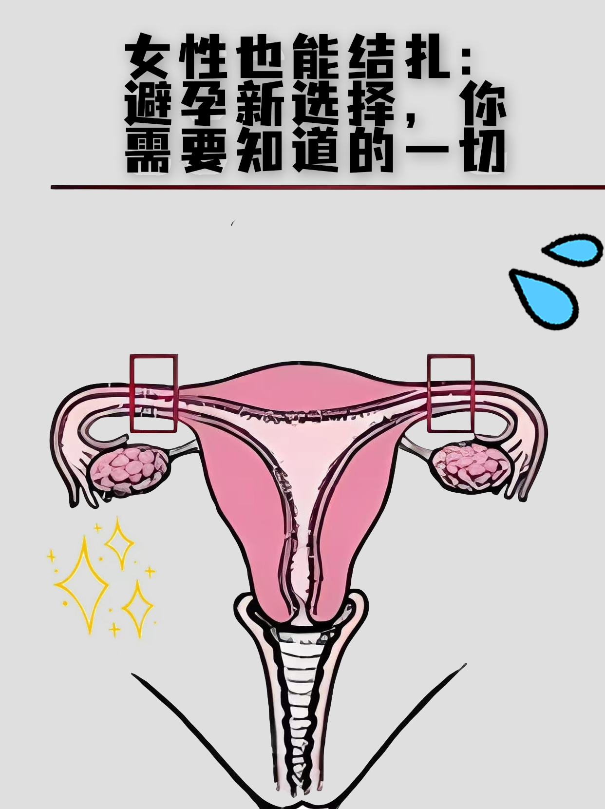 结扎女人图片