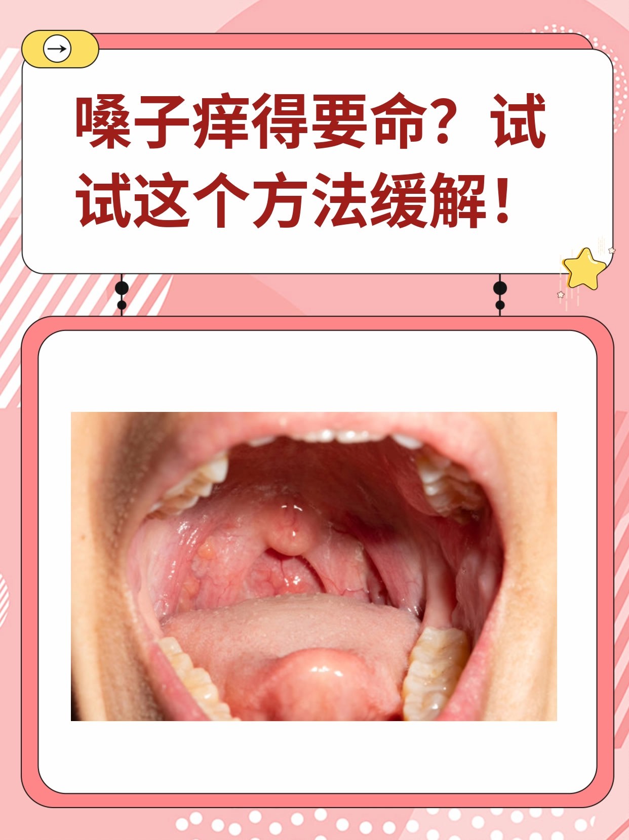 "我喉咙痒得难受😣,感觉有东西卡在里面,咳嗽也咳不出来