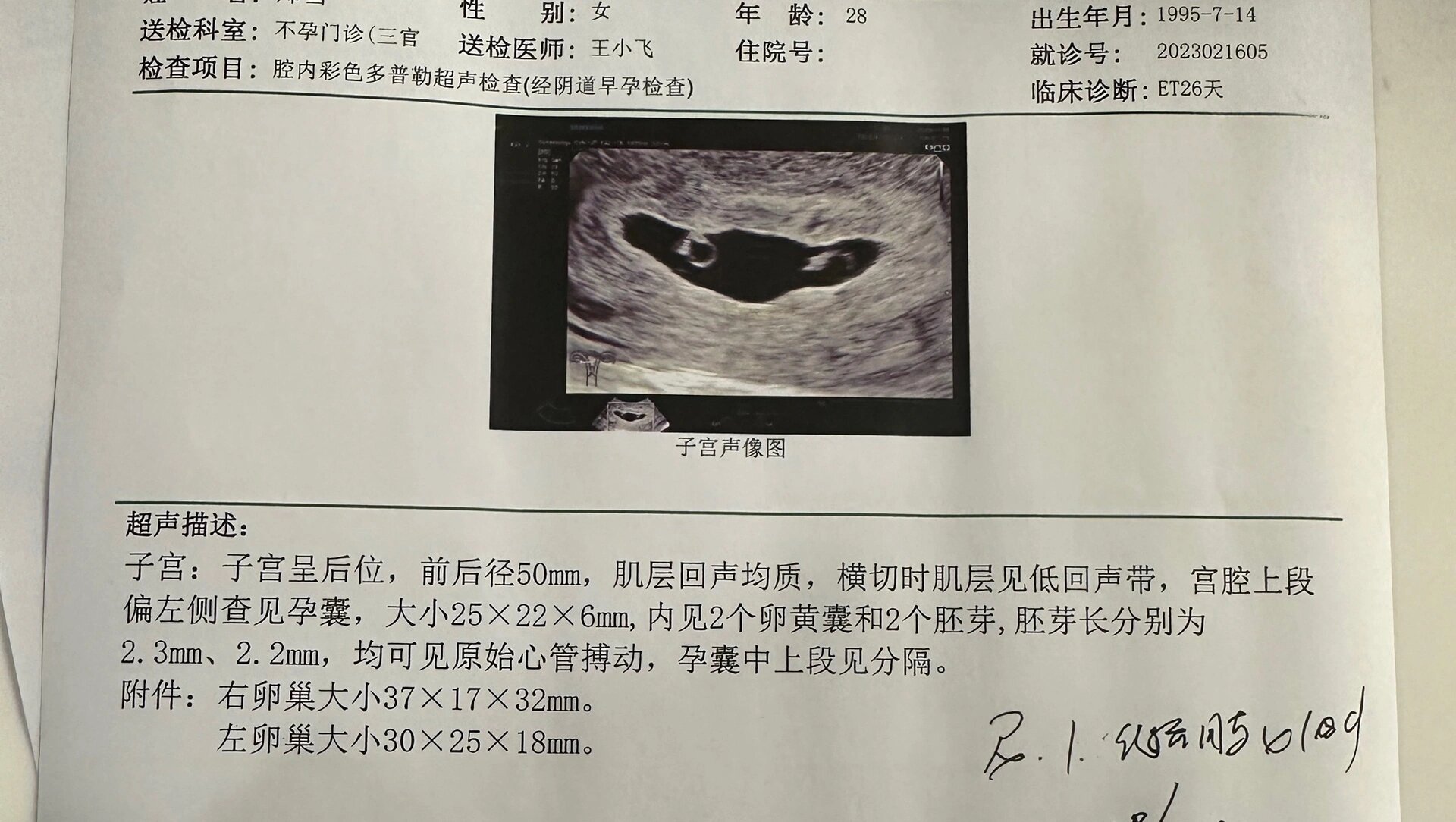 怀孕6周孕囊大小图片