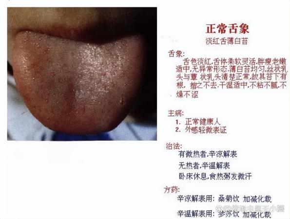 脾胃常见的10种舌象