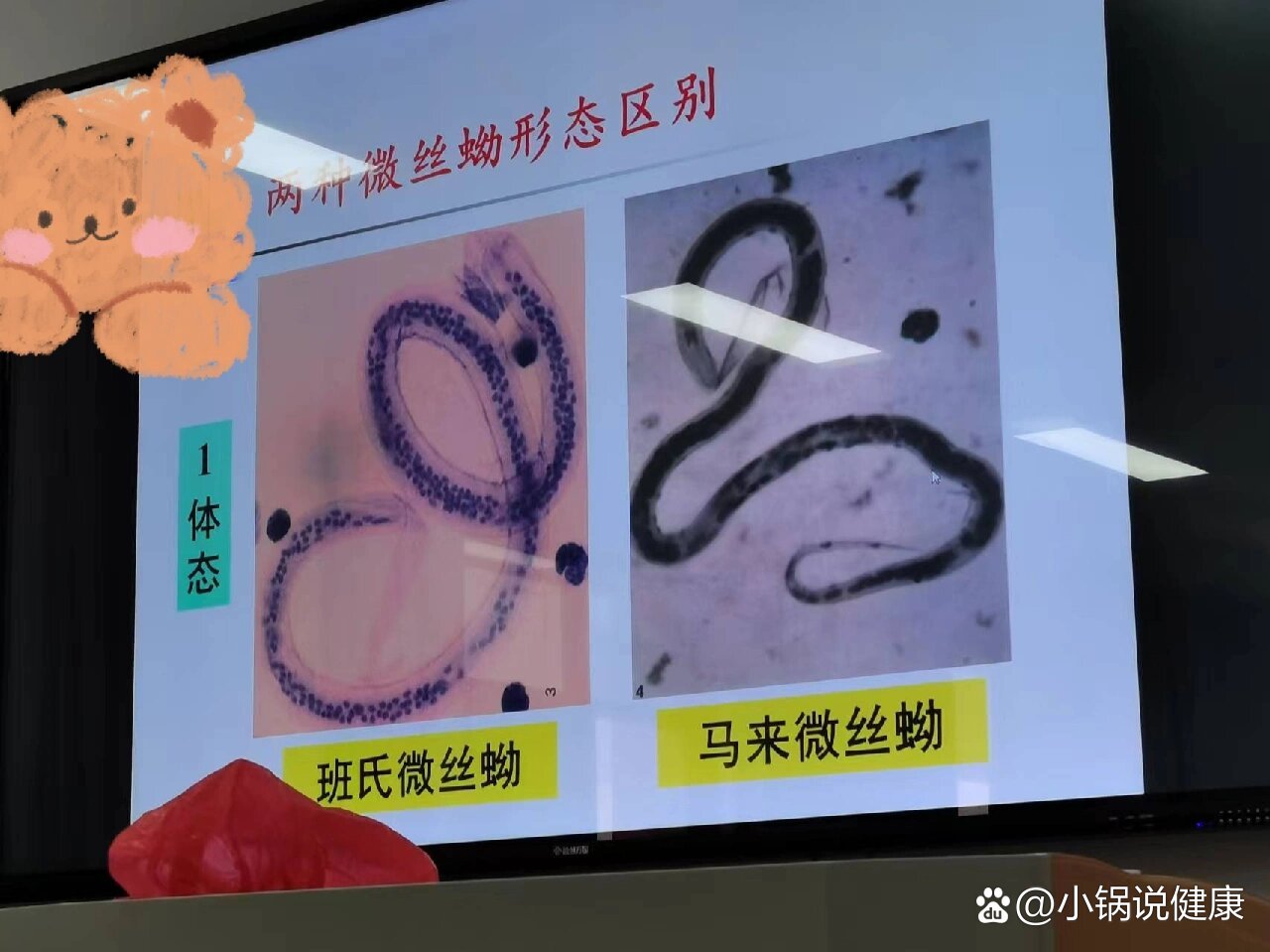 班氏微丝蚴and马来微丝蚴的鉴别