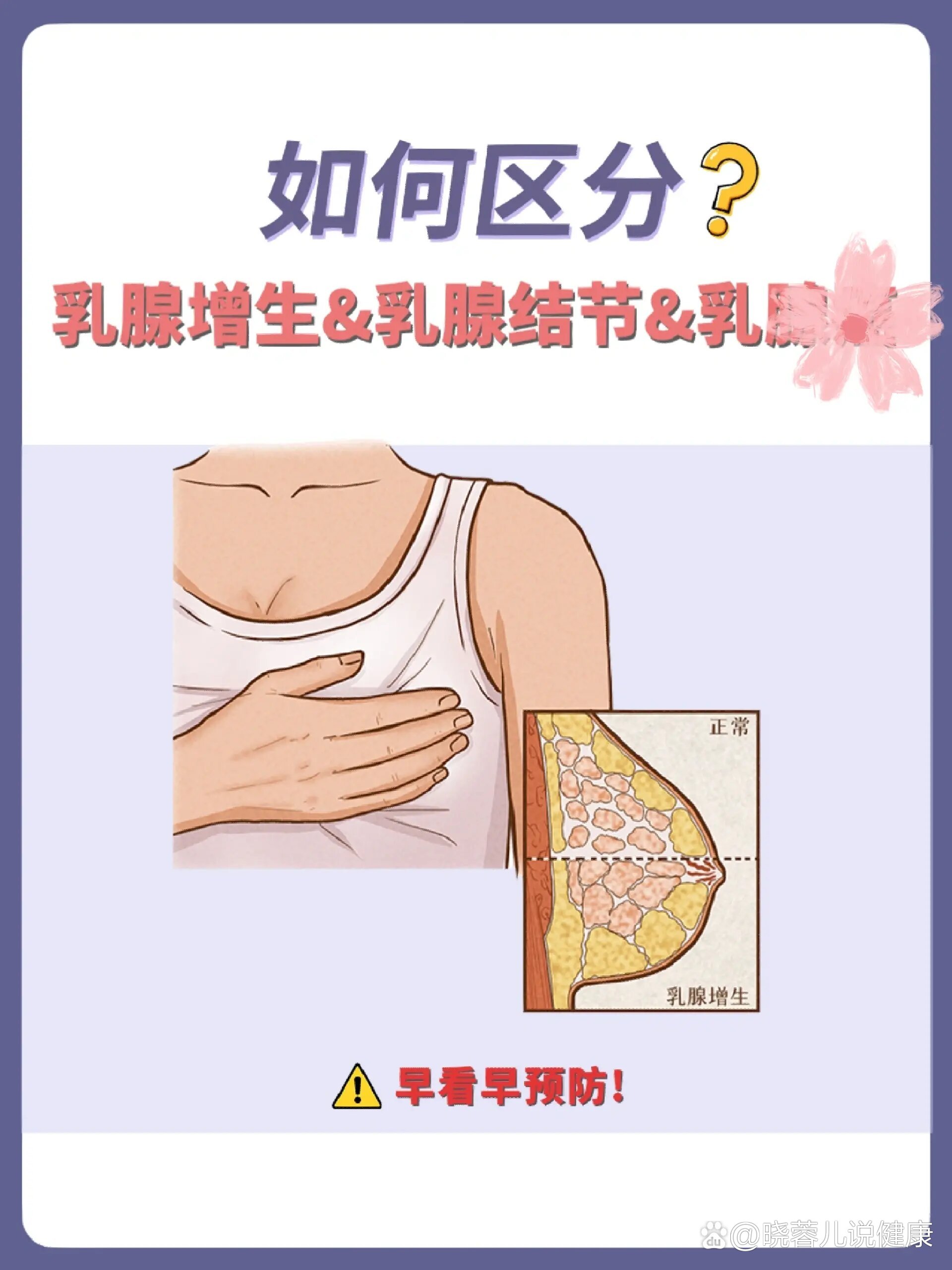 女人乳头为什么会变大的简单介绍