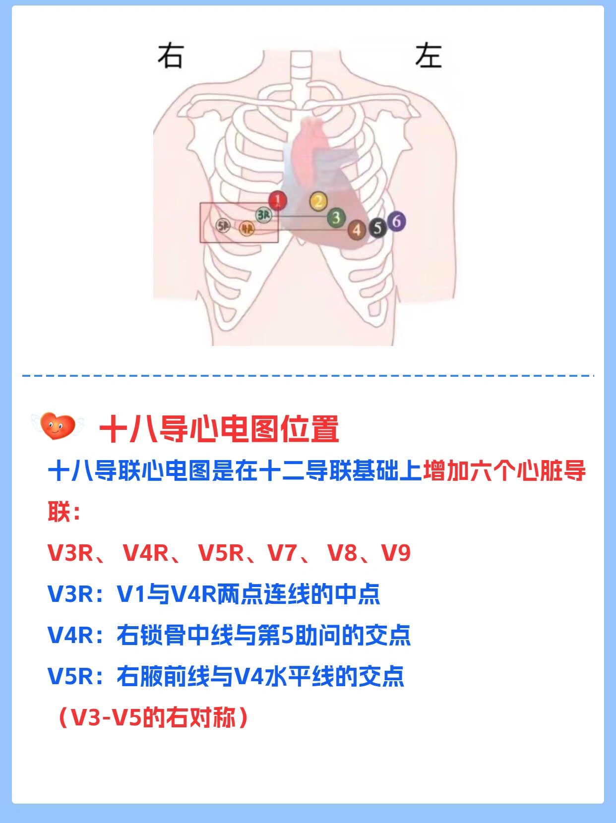 心电18导联的位置图片图片