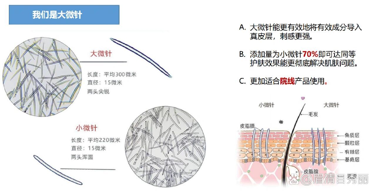 长针短针图片