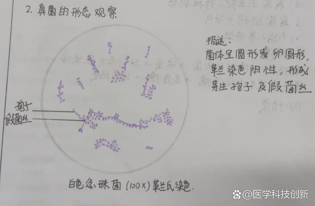 白色念珠菌革兰氏染色手绘