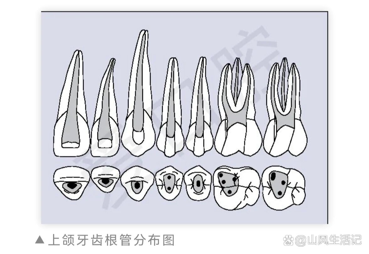 沟牙和管牙的区别图片