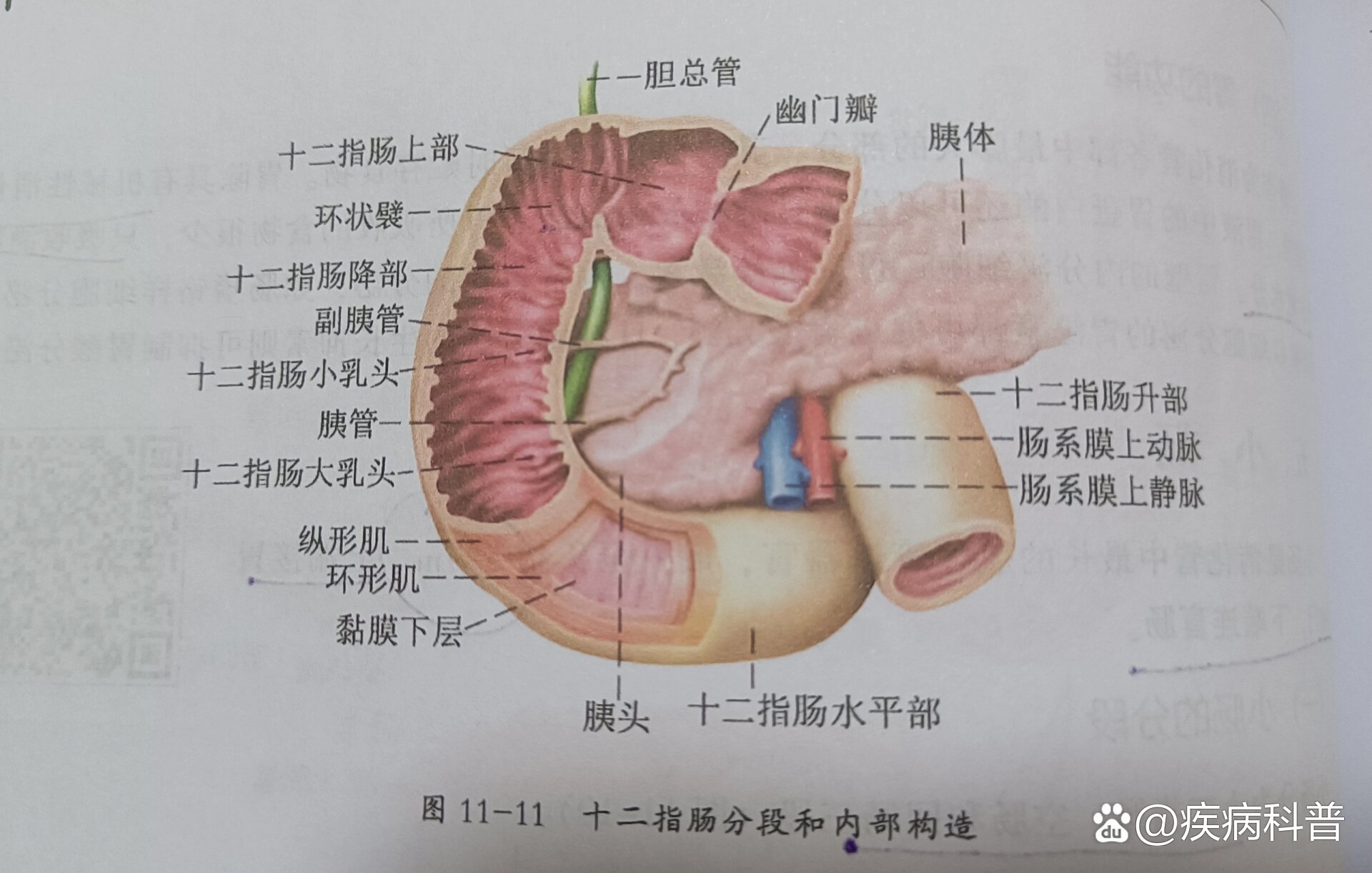 胆胰壶腹图片