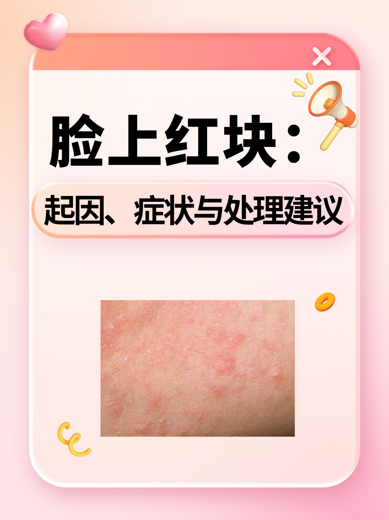 脸上红块:起因,症状与处理建议