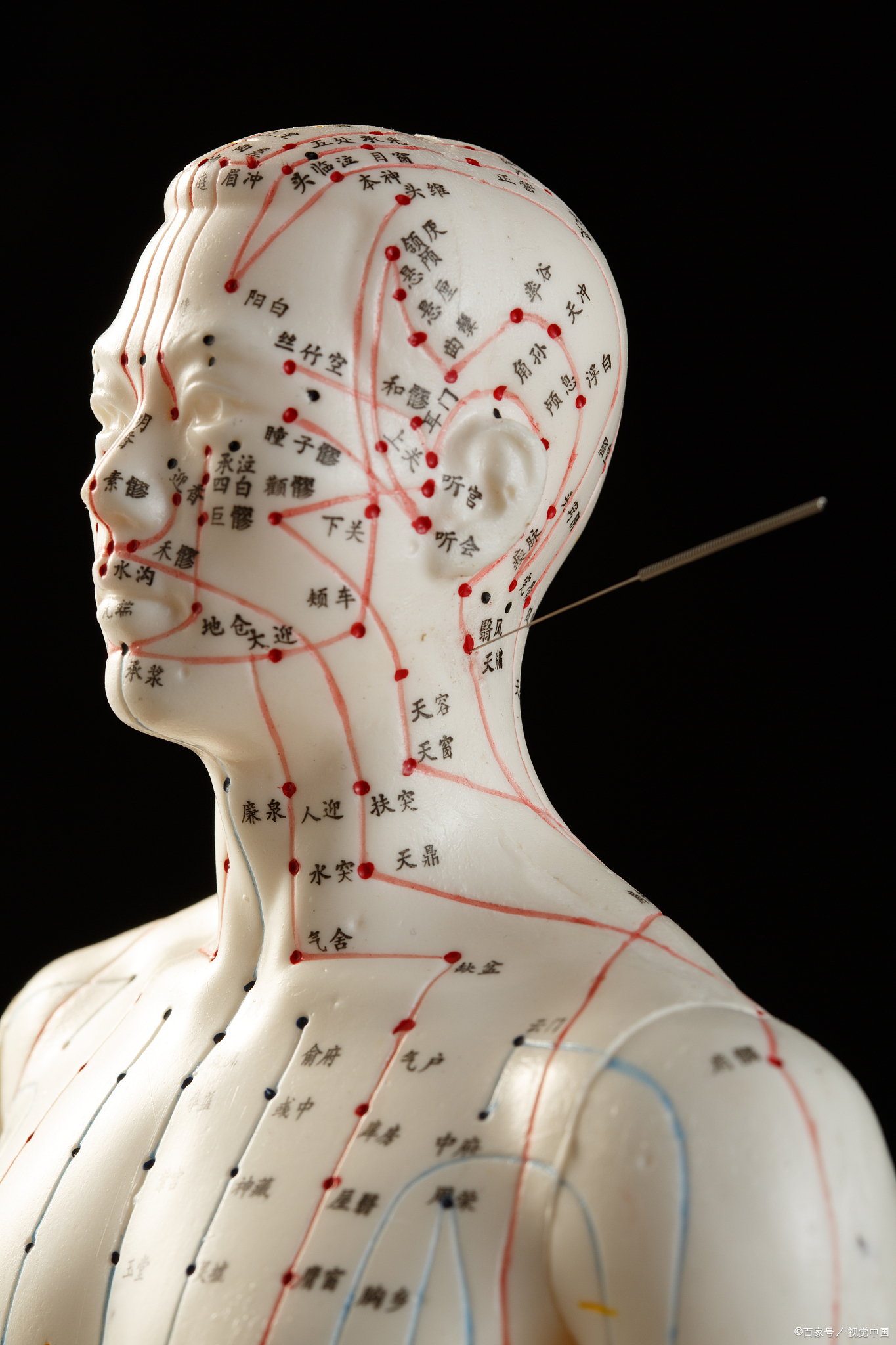 风池穴针刺方法探讨