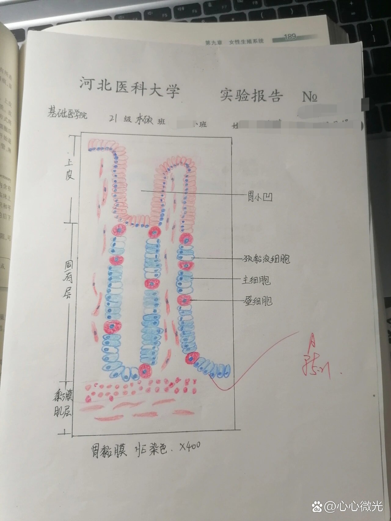 胃粘膜组胚切片