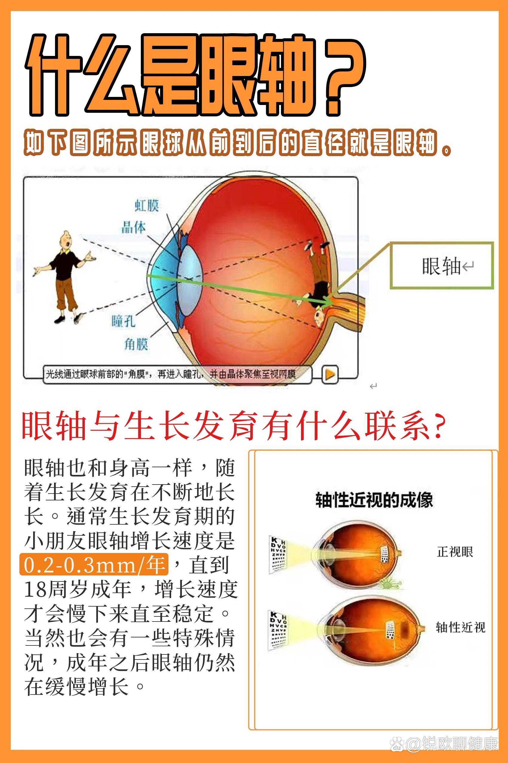 9915眼轴是什么?