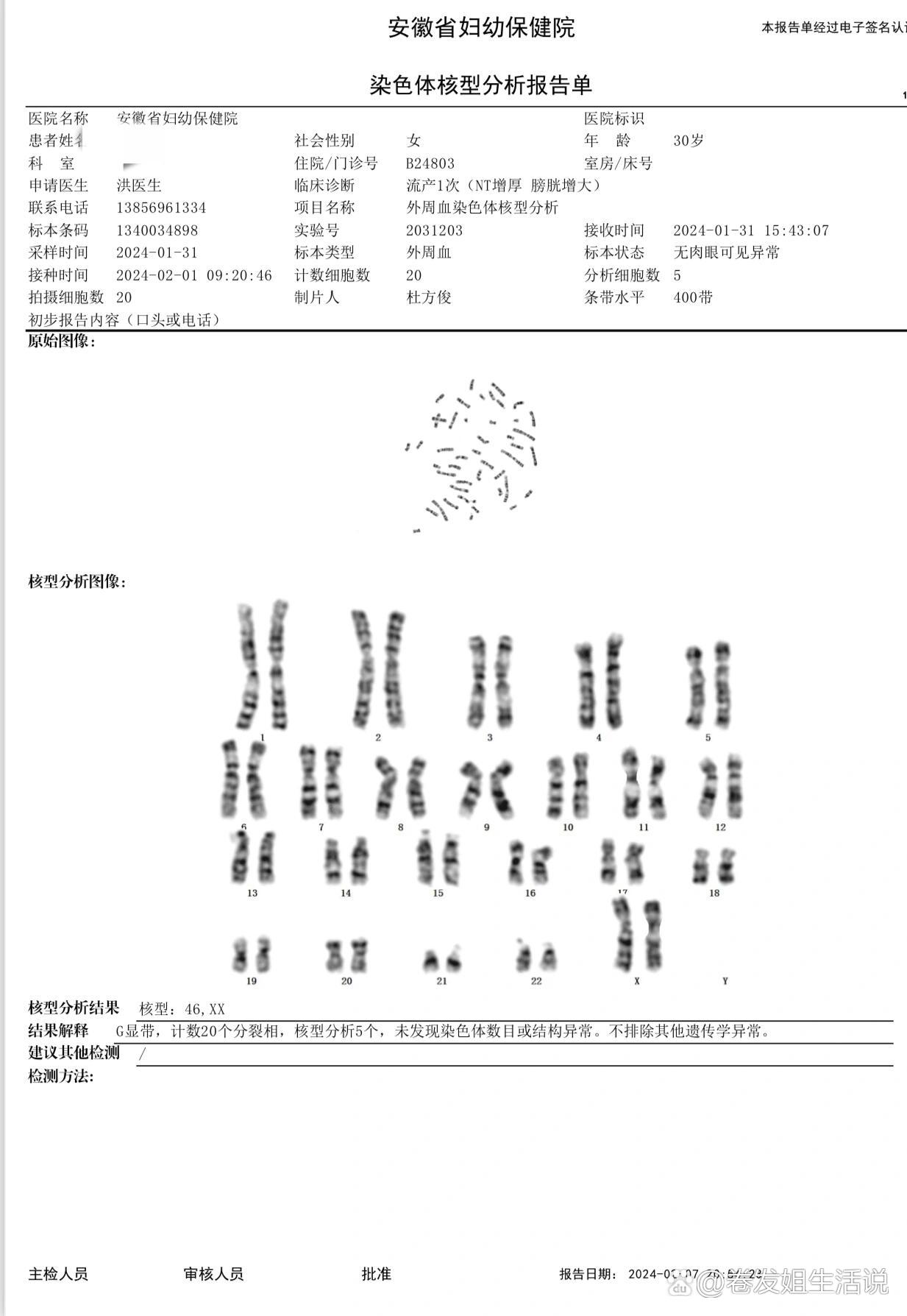 女性染色体报告图片