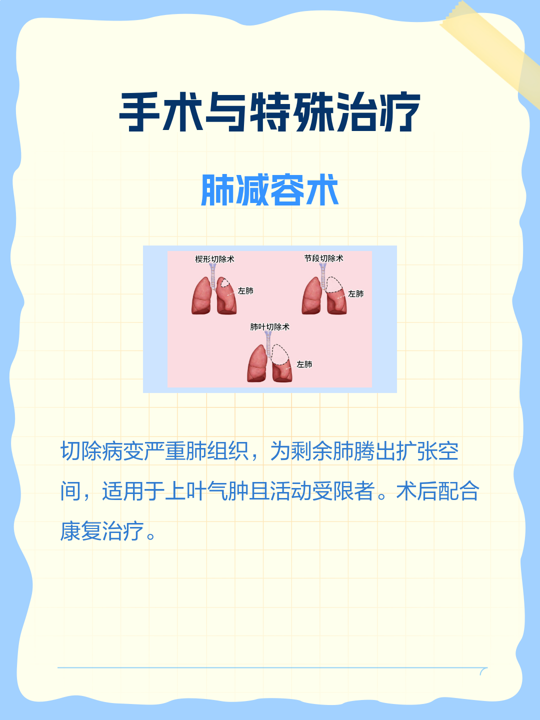 治疗肺部气肿| 百度健康·医学科普
