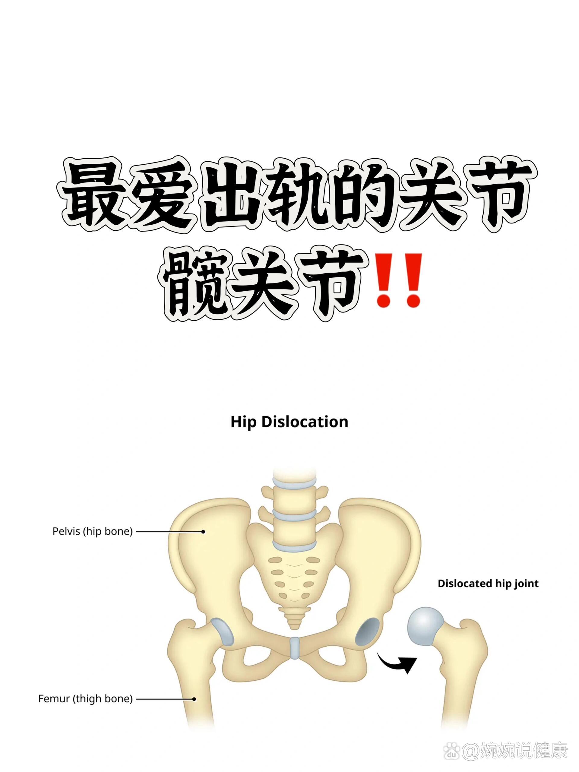 髋关节内收外展图解图片