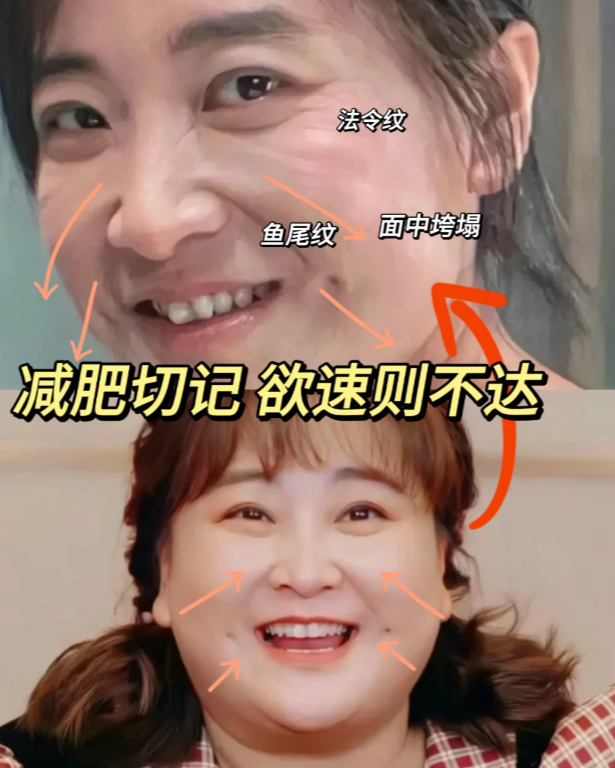 过度减肥真的会垮脸?