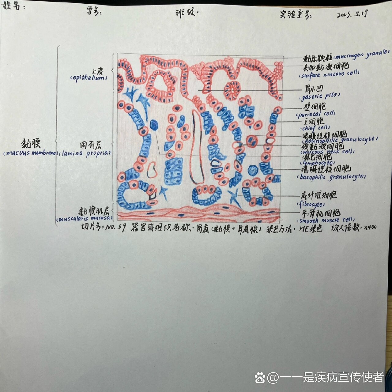 整个胃点胃溃疡手绘图图片