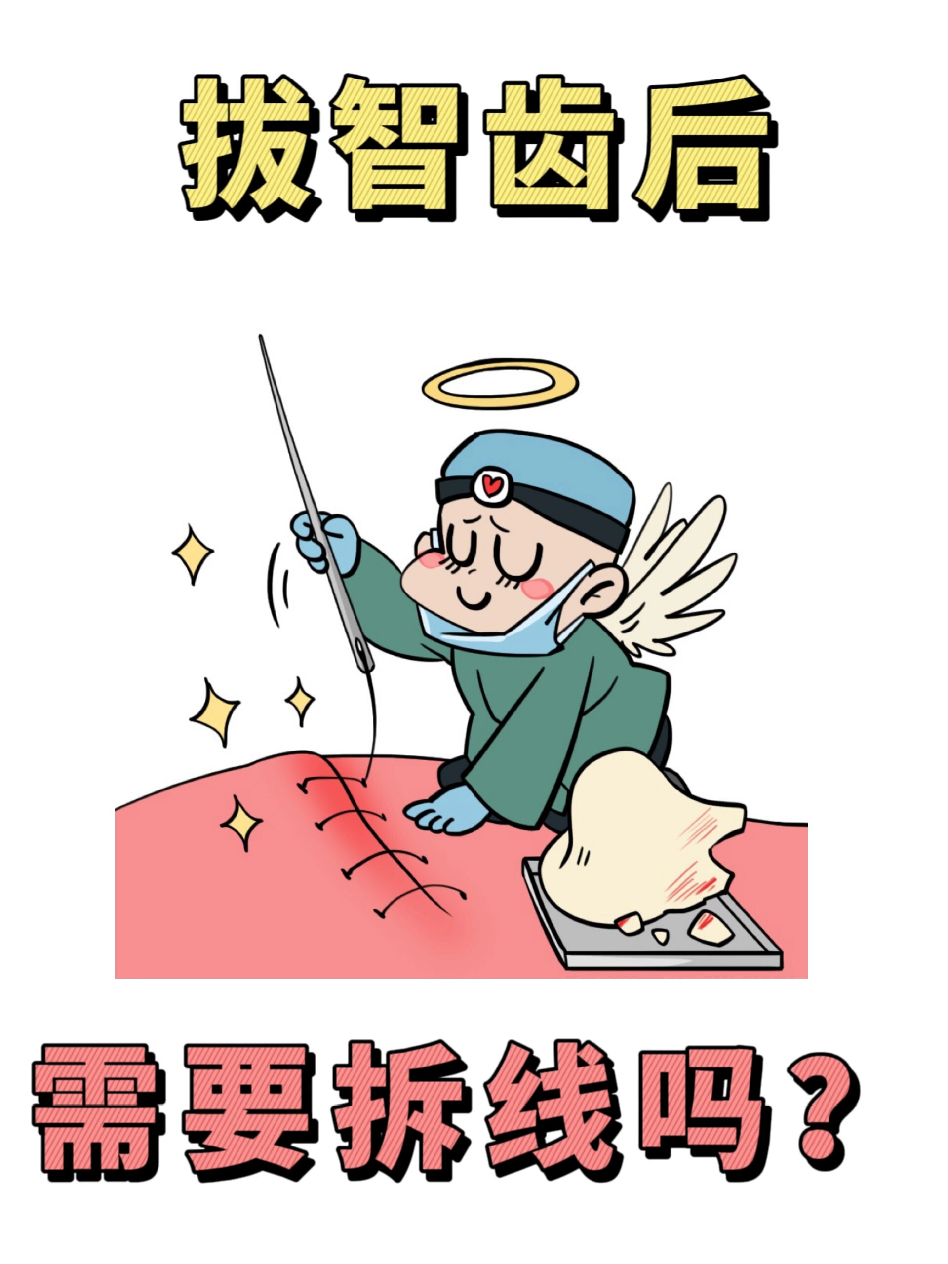 拔智齿后需要拆线吗?