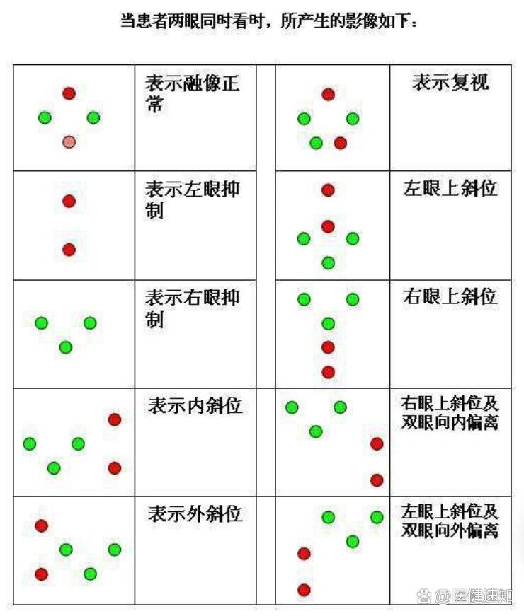 医用复视测试图片图片