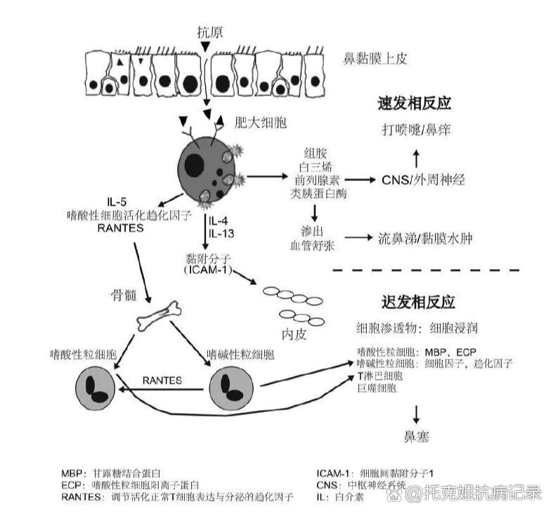 过敏性鼻炎的发病机制