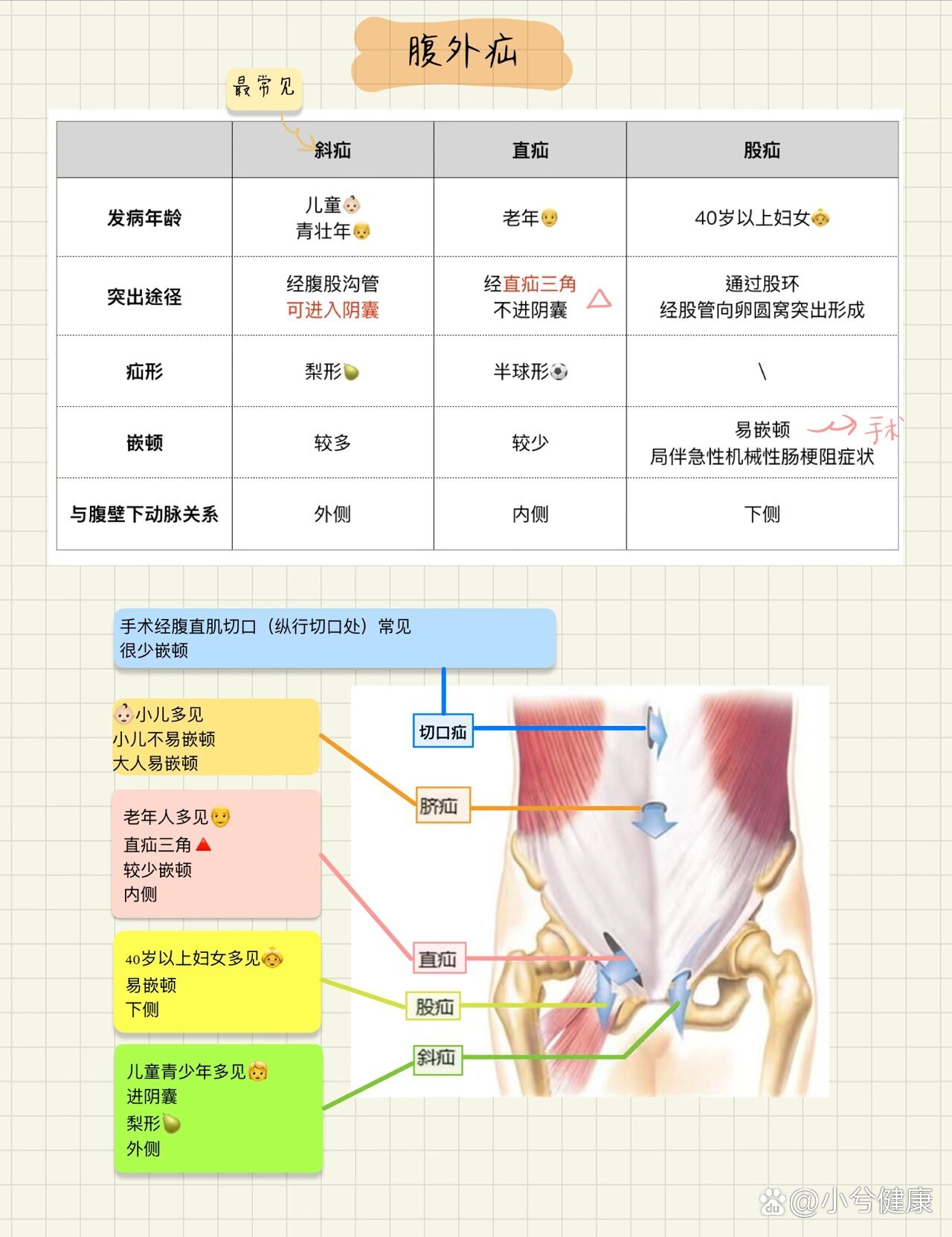 斜疝与直疝的鉴别表格图片